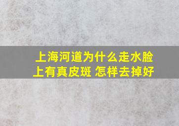 上海河道为什么走水脸上有真皮斑 怎样去掉好